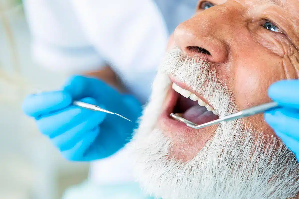 How long is the recovery after an apicoectomy blog.jpg